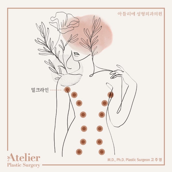 부유방제거 수술과 시술 중에서 고민한다면 사진 2