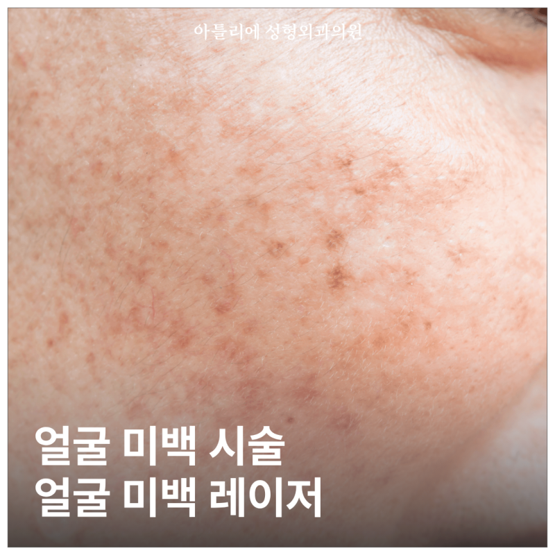 이수역 얼굴 미백 레이저 피코토닝 주근깨 제거 두피보톡스 병원 가격 찾고 있다면