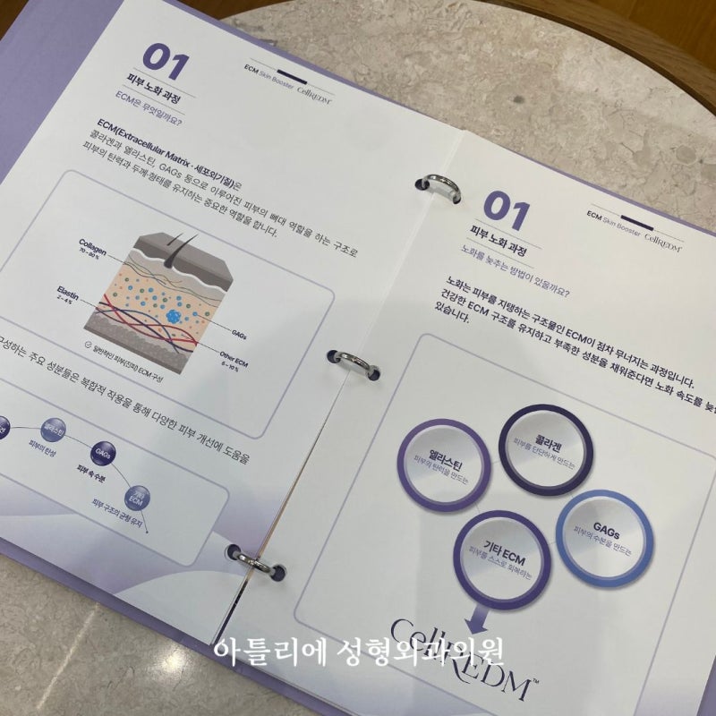 셀르디엠 효과 주기 리투오 차이 까지 총정리 해드립니다 사진 5