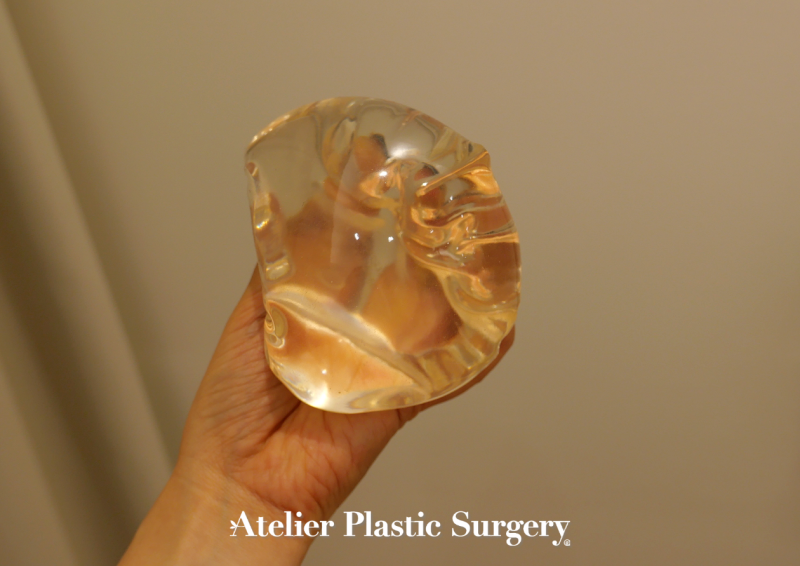 Breast Revision Surgery Reviews: Key Considerations Before Choosing Responsive Breast Implants 사진 6