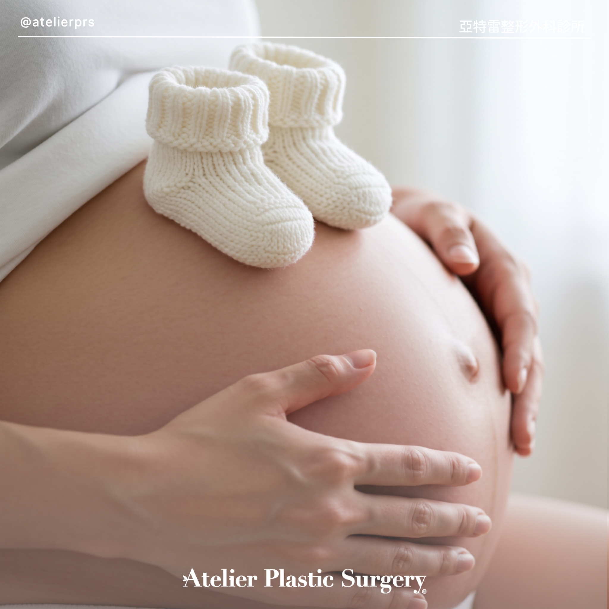 凹陷乳頭手術費用、乳暈變大縮小與大小胸矯正可以同時進行嗎？ 사진 3