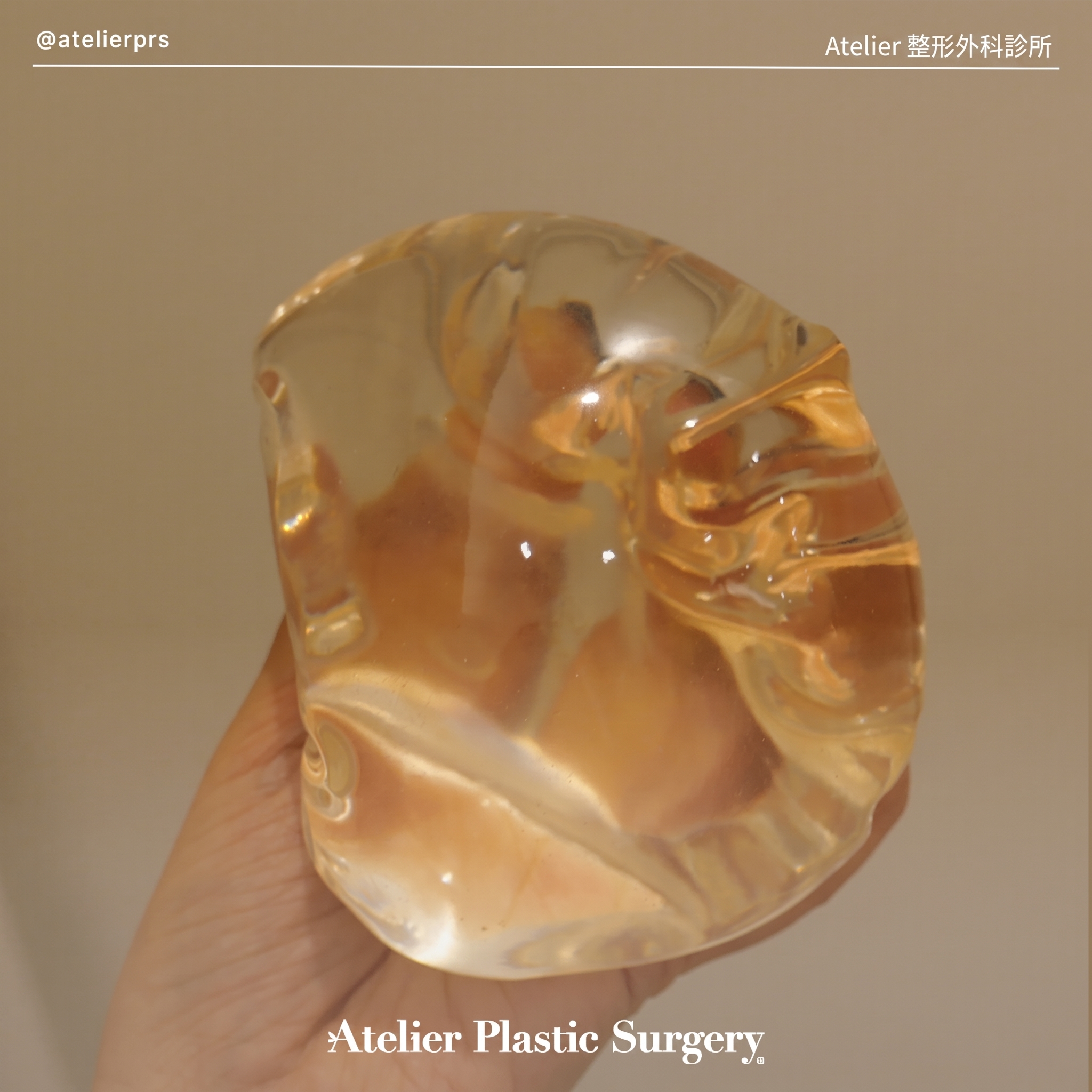 女性漏斗胸隆乳擔心乳房相連？請選擇專業隆乳權威診所 사진 3