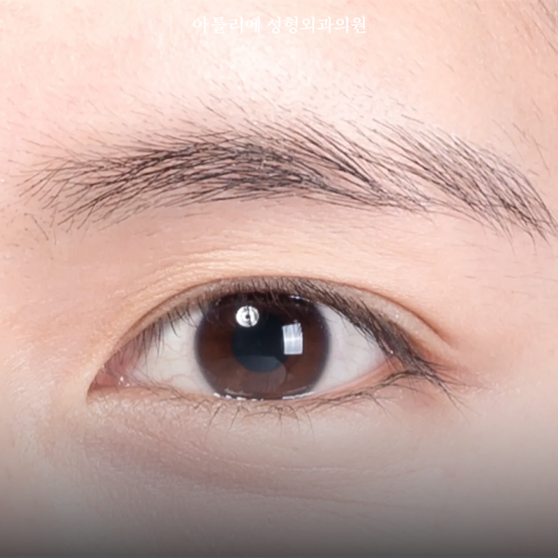 방배동 피부과 자려한 뜻 나에게 맞는 병원 고르는법 사진 4