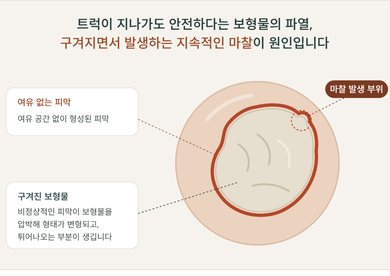 가슴 보형물 제거 후기 파열 증상 우려된다면? 사진 3